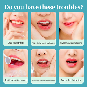 Soins de santé à domicile et médicaux Autres produits d'hygiène bucco-dentaire Gel buccal à action rapide pour la cicatrisation des plaies Soins des ulcères buccaux Gel en gros - Product Image 2