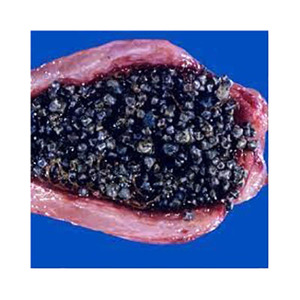 Livraison rapide calculs biliaires en pierre noire sécurisés dans des conteneurs d'exportation scellés - Product Image 2