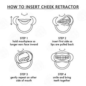 Écarteur de joue dentaire, ouvre-<span class=keywords><strong>bouche</strong></span> en forme de C, écologique, pour usage domestique, protège-dents pour blanchiment des dents, tailles S/M/L - Product Image 5