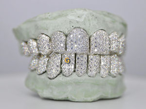 Hip Hop Personalidad Grillz Dientes Top Bottom Set con VVS Clarity Moissanite Diamond Iced Out Custom 925 Sterling Silver Grillz - Product Image 5