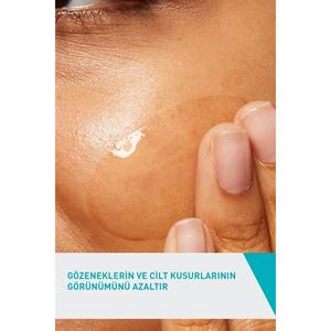 Gel per la cura del viso per la pelle soggetta ad Acne 40ml - Product Image 3