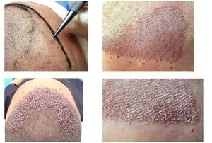 Mango de bisturí de diseño personalizado, el mango de bisturí más vendido, el mejor producto, mango de bisturí giratorio para la venta en línea - Product Image 4