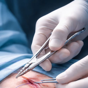 Pince à tordre et à couper les fils osseux orthopédiques, pince à tordre les fils de cerclage en acier inoxydable, orthopédie professionnelle - Product Image 5