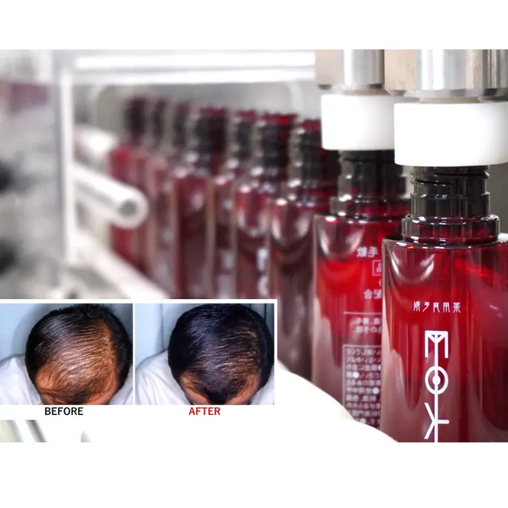 Professional long-selling best products good hair growth care private label hair growth oil