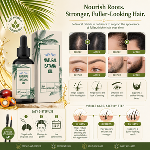 Aceite para el Crecimiento del Cabello de Marca Propia, Tratamiento Anticaspa para el Cuero Cabelludo, Crecimiento Rápido, Nutritivo, Aceite para el Cabello de Bebé, Aceite Orgánico de Romero y Ricino - Product Image 4