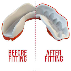 Protège-bouche en gomme de boxe personnalisé MMA protecteur de sécurité pour le sport - Product Image 5