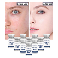 Ampoule d'infusion de cellules souches EGF avec peptides, sérum ciblant les signes de vieillissement, stimulant la croissance du collagène, cellules souches EGF
