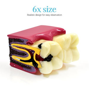 Tandheelkundige Tanden Model 6x Maat Molaire <span class=keywords><strong>Endo</strong></span> Wortelkanaalbehandeling Onderwijs Demo Model Rct Tanden Verval Observatiemodel - Product Image 4