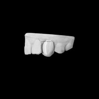 Capuchon en or Grillz à dent unique personnalisé fait à la main 10K/14K couvercle de dent en or pour les dents supérieures Style Hip Hop pour hommes et femmes