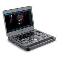 Ecógrafo Doppler Color Digital Portátil SonoScape X5 X5V con una Sonda para Diagnóstico Veterinario Equino