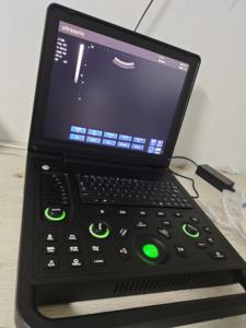 Ecografo Portatile Veterinario Digitale da <span class=keywords><strong>8</strong></span> Pollici, Apparecchiatura Diagnostica a Ultrasuoni Doppler Portatile Cinese - Product Image 2