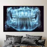 Tableau sur toile imprimé Art Déco, motif dents radiographiées, pour décoration murale de cabinet dentaire, panneau sur toile encadré