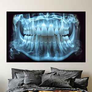 Lienzo Impreso: Diseño de Mandíbula en Rayos X para Decoración de Consultorio Dental, Lienzo Enrollado - Product Image 1