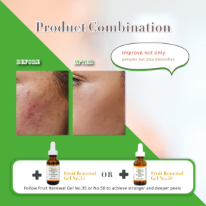 Sérum Exfoliant Liquide à l'Acide Salicylique 30% B.H.A pour Estomper les Taches Brunes et Soin des Pores OEM - Product Image 5