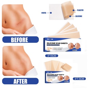 Pansements en silicone South Moon pour cicatrices, dispositifs de correction chirurgicale, patchs pour l'élimination et la cicatrisation des plaies, traitement des brûlures cutanées - Product Image 6