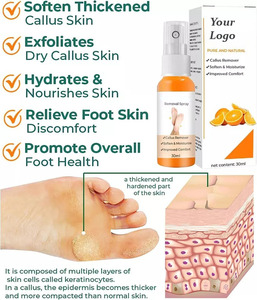 Customizable Logo Foot Care Spray Green Tea Orange Foot Exfoliate Peel Off Spray Cracked Heels Dead Skin <b>Calluses</b> Bulk Orders - Product Image 2