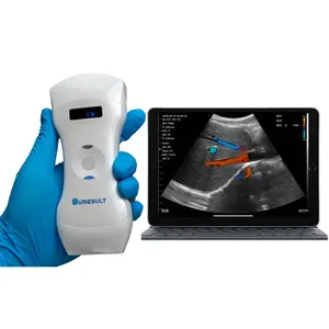 Suministro de Fábrica Suresult D3L 3 en 1 Ecógrafo Inalámbrico Portátil Doppler Color, Ecógrafo Móvil de 192 Elementos Lineales, DIY OEM ODM - Product Image 2