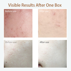 Dr.Innoderm penguat kulit PDRN Korea, ampul Salmon DNA Serum kuat memperbaiki rumah perawatan mencerahkan Anti Penuaan MTS terapi - Product Image 5