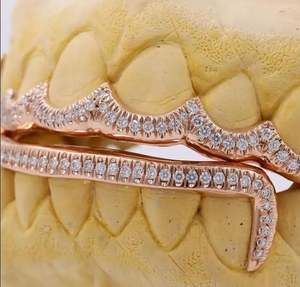 18K Gold Drip Grillz Hip Hop Fine Piercing Jewelry pour hommes et femmes Rose Gold Silver Teeth Grills - Product Image 3