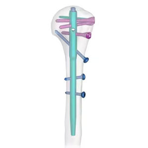 ตะไบเล็บหลายมิติแบบใช้ซ้ำได้มีหลายมิติสำหรับฝังกระดูกทำจากสเตนเลสกระดูกต้นแขน - Product Image 6