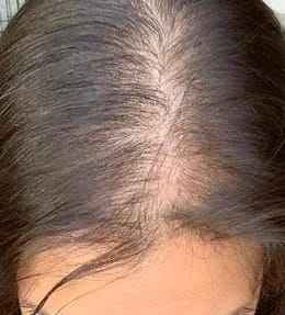 Toppers y parches de cabello 100% humano - Product Image 5