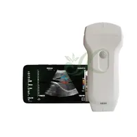 Máquina de Ultrasonido Portátil para Diagnóstico Veterinario con Doble Sonda Convexa/Lineal/Phased Array, Modos de Escaneo para Análisis Portátiles (Modelo