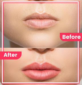 OEM/ODM Masque de sommeil hydratant pour les lèvres Baume à lèvres hydratant de nuit avec acide hyaluronique au prix de gros - Product Image 4