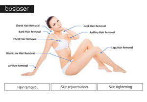 Tripo médical Laser équipement de beauté indolore 808nm Diode Laser système d'épilation Diodo Ice Depilacion Laser pour l'épilation - Product Image 5