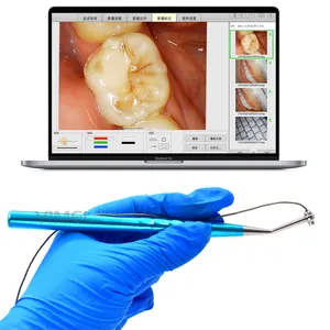 Portable Dental Endoscope Compact Easy To Install Micro Intra-oral Camera USB Connection For Dental Laboratory Clinic