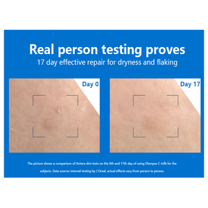Lozione idratante senza profumo JALIYA 8 FLOZ/238 ml per il corpo sviluppata con dermatologi per la <span class=keywords><strong>pelle</strong></span> <span class=keywords><strong>secca</strong></span> e <span class=keywords><strong>molto</strong></span> <span class=keywords><strong>secca</strong></span> - Product Image 3