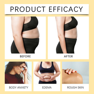 Herbes végétariennes naturelles pures de marque privée OEM 100% extrait naturel perte de poids <span class=keywords><strong>anti</strong></span>-<span class=keywords><strong>cellulite</strong></span> crème amincissante ventre cuisse hanches - Product Image 4