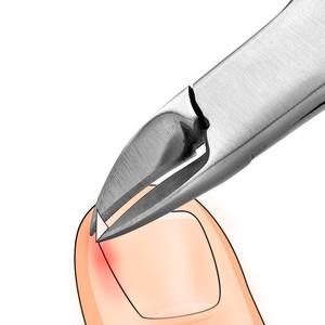 Coupe-cuticules professionnel, outils de suppression des peaux mortes, pinces à ongles en acier inoxydable de qualité supérieure, Pakistan - Product Image 6