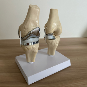 Modelo de prótesis de rodilla Artificial desmontable de calidad superior conjunto de modelo de implante de articulación de rodilla dorado pequeño único hecho en Pakistán - Product Image 5