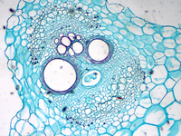 BestScope BLM-205 LCD Digital Biological Microscope with 7 Inch LCD Screen and 2MP Digital Camera
