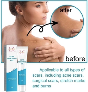 Gel Bio OEM ODM en Gros pour l'Élimination des Cicatrices Chirurgicales, Brûlures et Blessures – Réparation Avancée des Cicatrices, Validé par des Essais Cliniques - Product Image 5