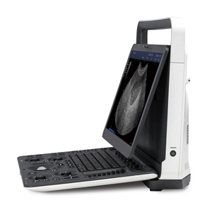 SonoScape E2 ProV Sistema de Ultrasonido Doppler Color Veterinario Portátil con Una Sonda, Escáner de Ultrasonido E2 Pro, Precio de Distribuidor - Product Image 4