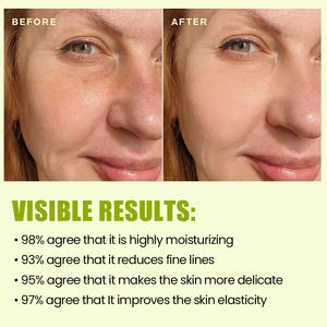 Private Label Natürliches <span class=keywords><strong>Vitamin</strong></span> C Hagebutten öl Gesichts öl White ning Anti Aging Reparatur Feuchtigkeit spendende Hautpflege Hautpflege Gesichts öl - Product Image 6