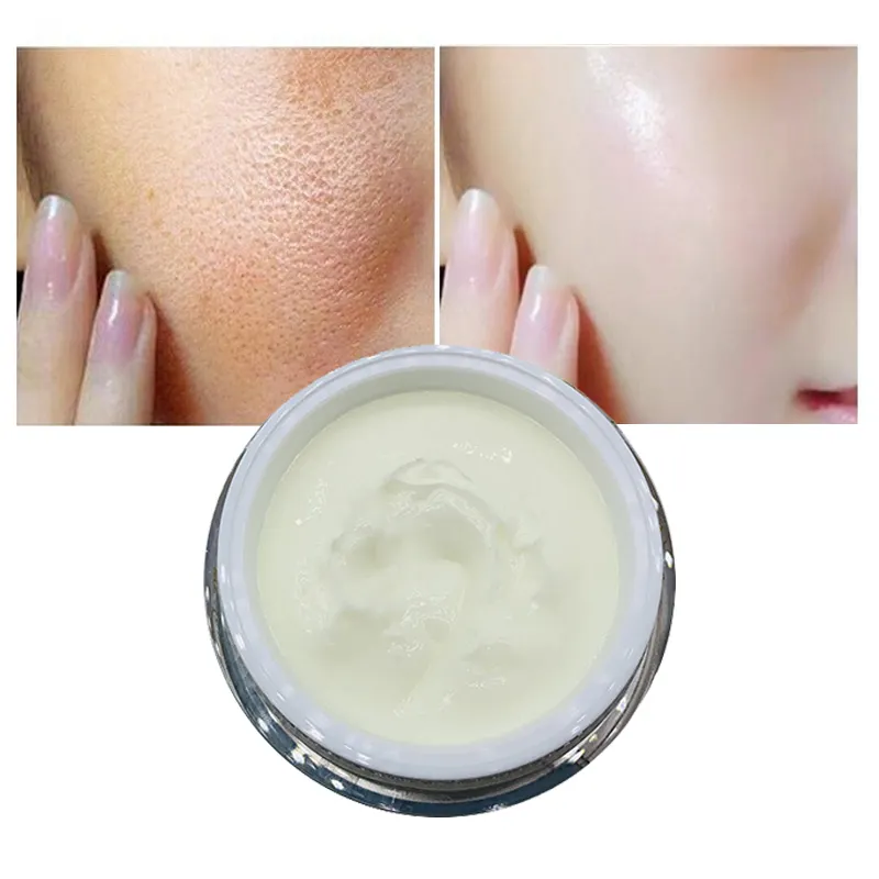 Private Label OEM 50g Female Anti Aging Facial Wrinkles Black Spots Beauty Niacinamide Whitening Face Cream Skin Care Products