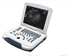 Máquina de ultrasonido portátil digital Escáner ultrasónico humano B CE ISO 5 sondas - Product Image 4