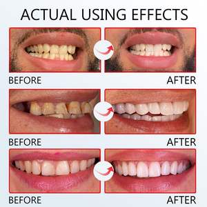 Dentifrice blanchissant probiotique SP-6 pour l'élimination des taches et l'élimination de la mauvaise haleine, éclaircissant avec Lactobacillus, sans danger pour l'émail, soin buccal quotidien 120g - Product Image 4