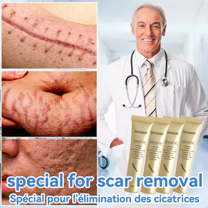 Fatazen Bài Mụn Trứng Cá Đánh Dấu Corrector Đỏ Giảm Sẹo Sửa Chữa Kem Nhãn Hiệu Riêng Mụn Trứng Cá Giảm Kem Loại Bỏ Vết Sẹo Kem - Product Image 3