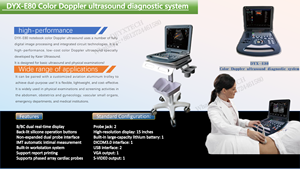 Écographie facultative portative d'Usg 4D de couleur pseudo numérique de balayage médical d'ultrason <span class=keywords><strong>3D</strong></span> - Product Image 6