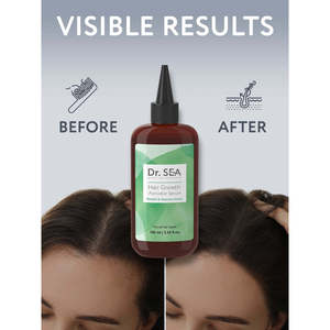 เซรั่มบำรุงผิว-100มล.-เมนทอลและโรสแมรี่สำหรับการเจริญเติบโตของเส้นผม - Product Image 6