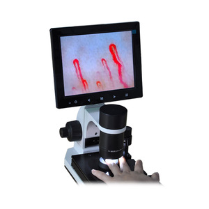 Chuyên nghiệp nailfold vi tuần hoàn màn hình cho Bệnh Tiểu Đường chăm sóc các biện pháp tế bào máu Loại Tốc Độ kính hiển vi - Product Image 1