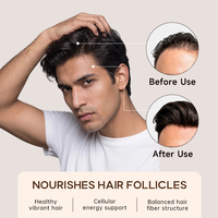 Comprimés personnalisés pour la croissance des cheveux chez l'adulte, soutien à l'épaississement des cheveux, traitement de la perte de cheveux post-partum, suppléments à base de plantes à action rapide