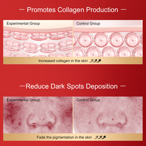<span class=keywords><strong>C</strong></span> vitamini Infused cilt bakımı seti Centella hydraca nemlendirici ve beyazlatma gençleştirme kiti anti-kırışıklık yüz cilt bakımı Suit - Product Image 2