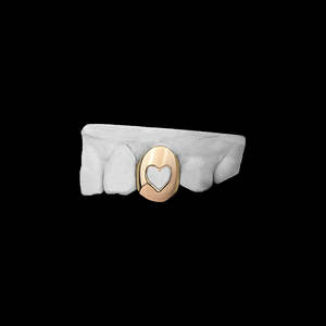 Grillz dentaire unique rose, design creux en forme de cœur, fait main, personnalisé, romantique, avec moissanite, plaqué or 14K, pour la Saint-Valentin - Product Image 3