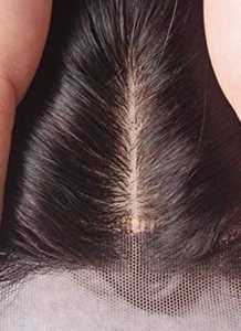 100% Human <b>Hair</b> <b>Toppers</b> & Patches - Product Image 4