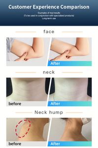 High Quality Inner <b>Massage</b> <b>Roller</b> Cellulite Reduction Weight Loss Body Shape Beer Belly <b>Neck</b> Hump Butterfly Arm Slimming Machine - Product Image 6