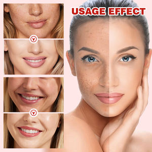 XUEYI Niacinamide 10% tranex4% asit karanlık nokta düzeltici kızdırma serumu kaldırmak - Product Image 2